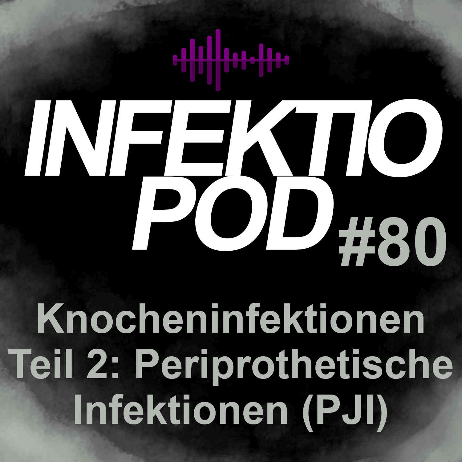 infektiopod